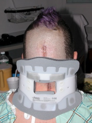 Back of head in brace